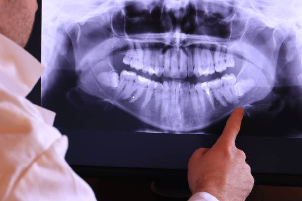 Best Emergency Dentist for Knocked-Out Tooth in West Deland, FL